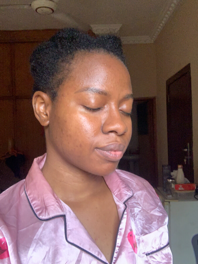 beauty-blogger-iruoma-right-face-on-4th-august